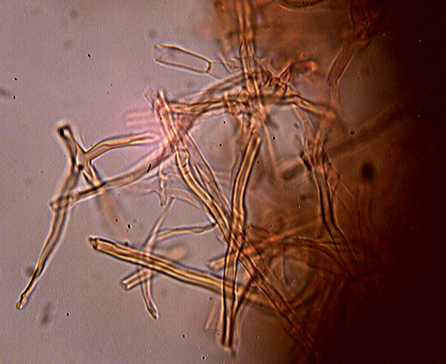 Funghi da dieci centesimi